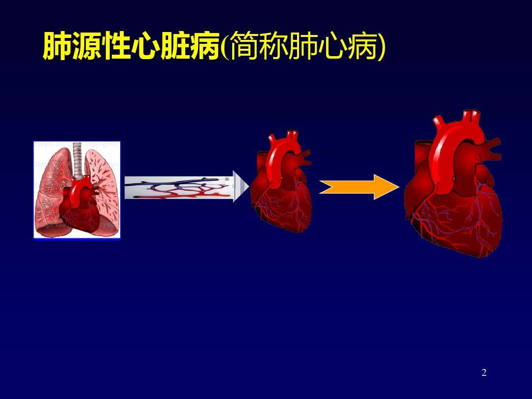 慢性肺源性心脏病 PPT课件