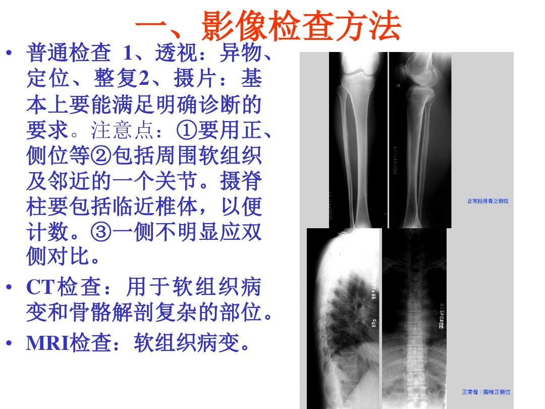 骨关节系统影像表现及诊断