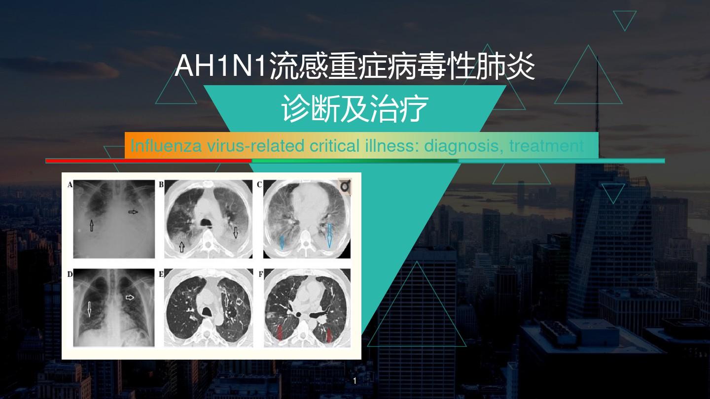 AH1N1流感重症病毒性肺炎诊断及治疗