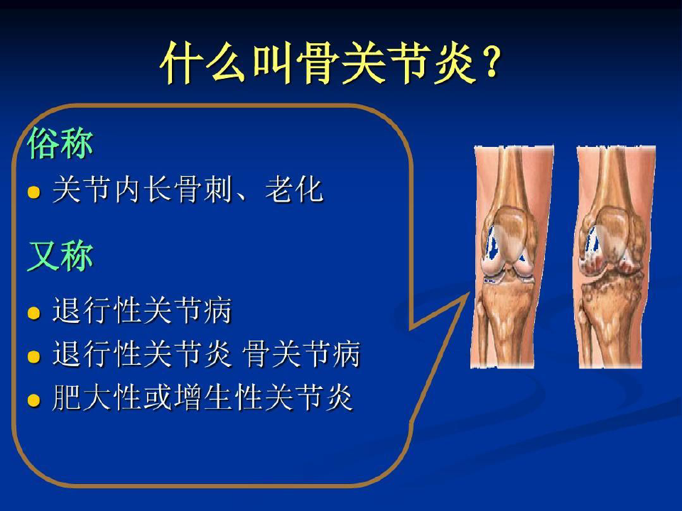 膝关节骨性关节炎的阶梯治疗81页PPT
