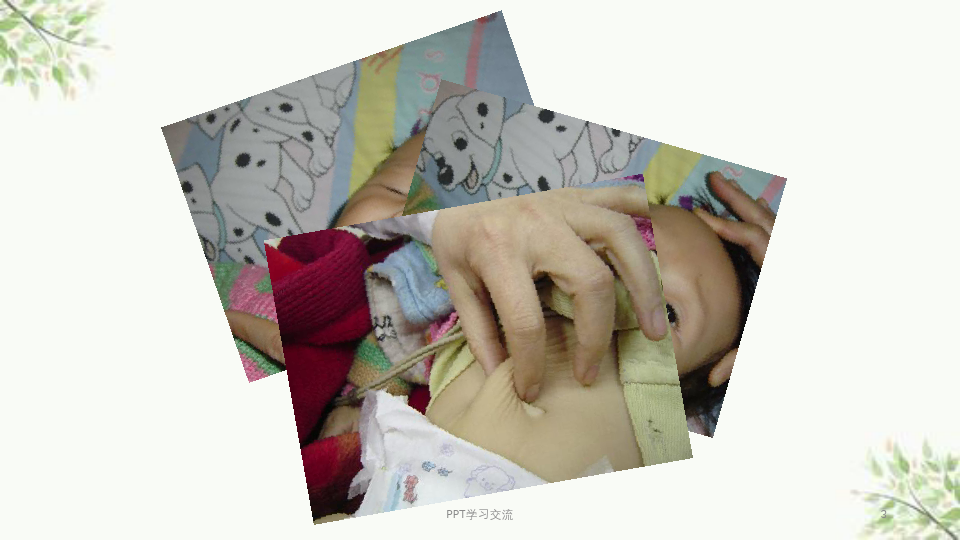 儿童腹泻病的液体疗法ppt课件