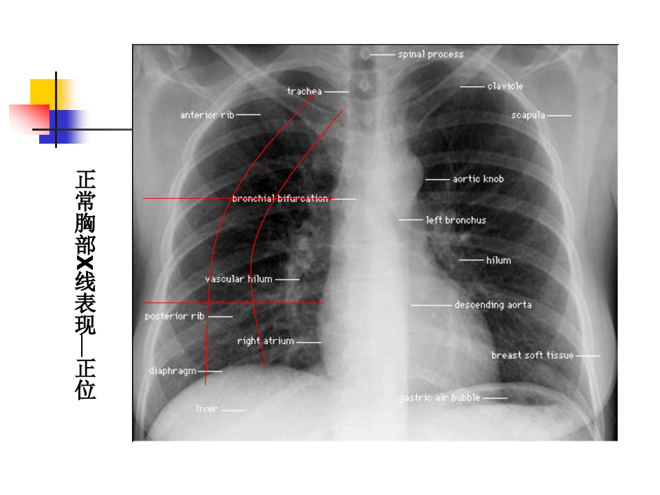 肺部疾病的影像学基础