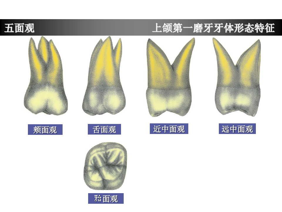 上颌第一磨牙牙体形态简述(2)
