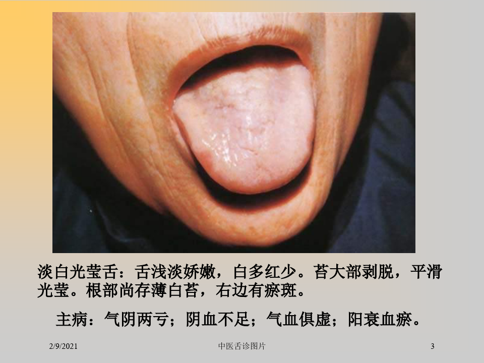 中医舌诊图片课件