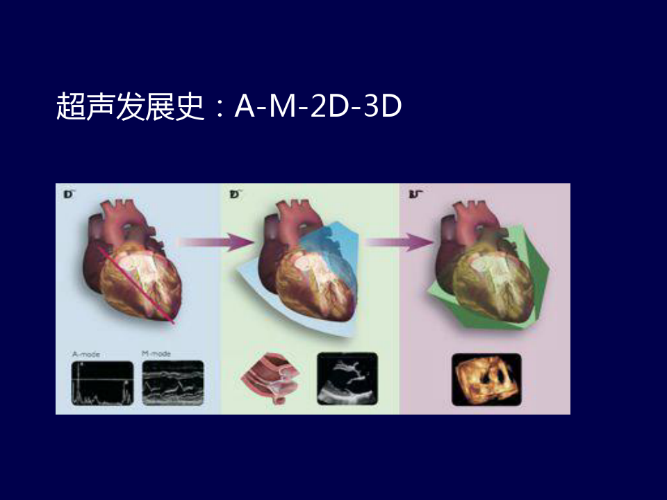 心脏超声新技术及其临床应用