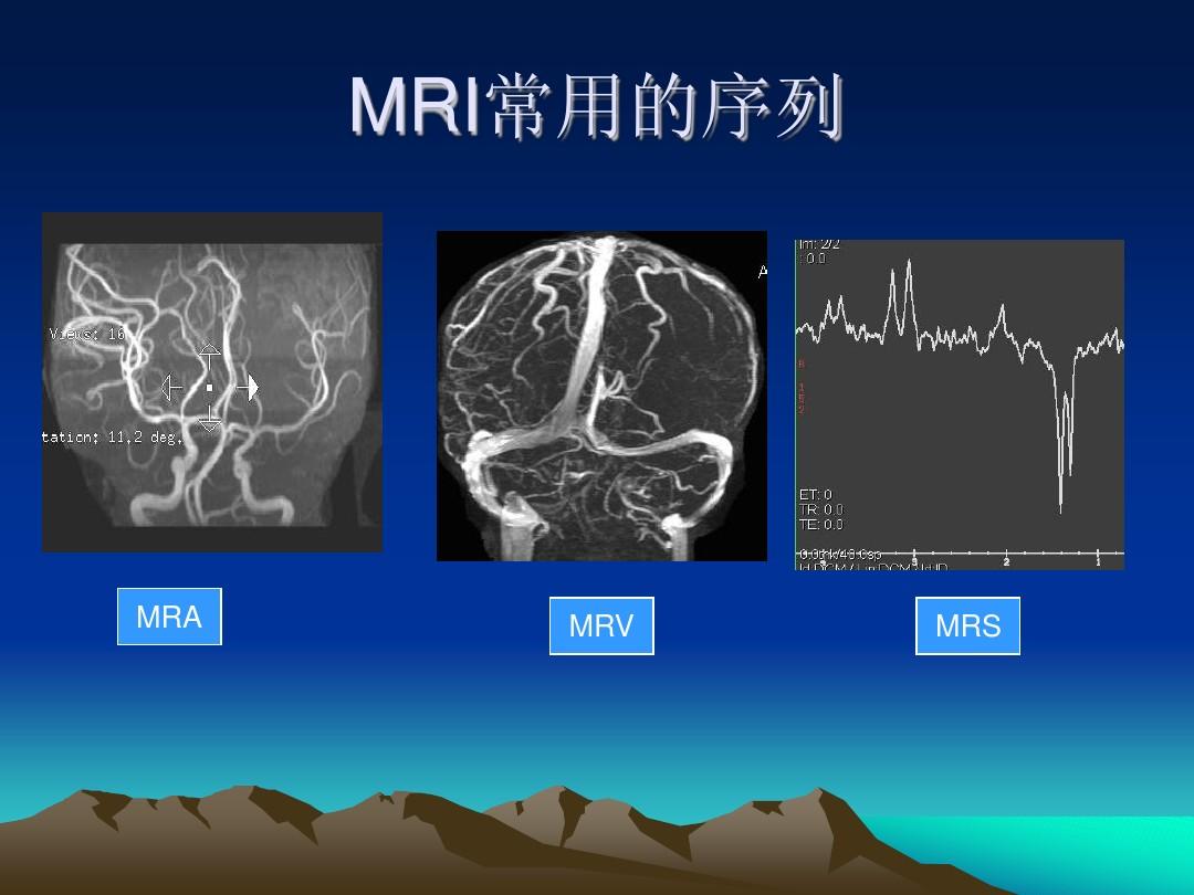 头颅MRI断层解剖