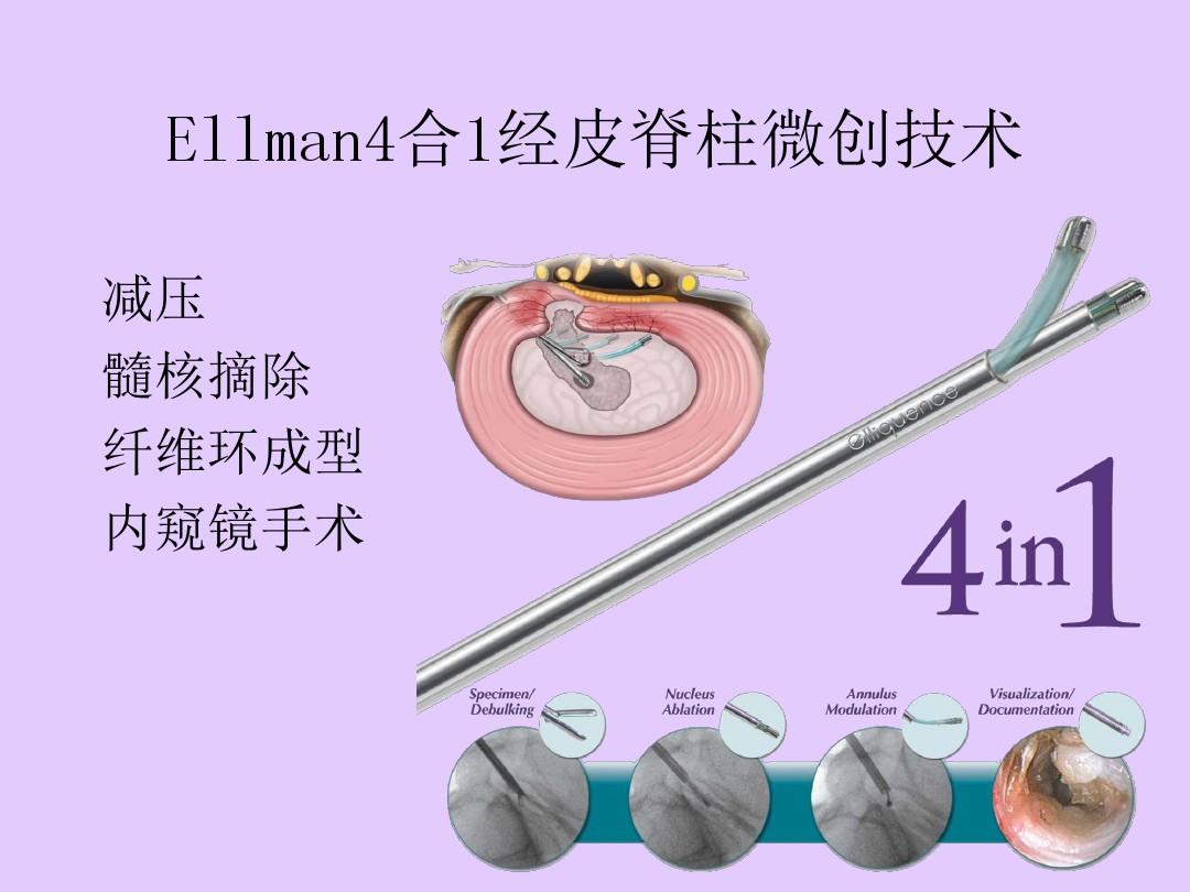 Ellman4合1经皮脊柱微创技术