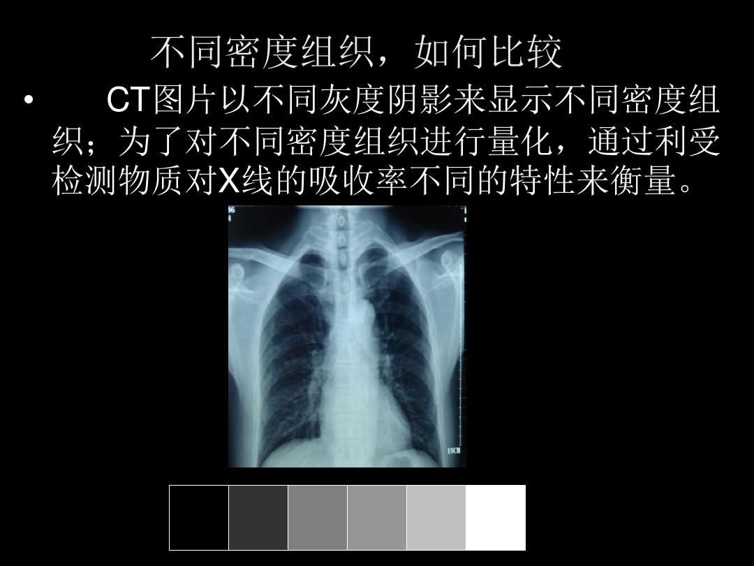 肺部影像学