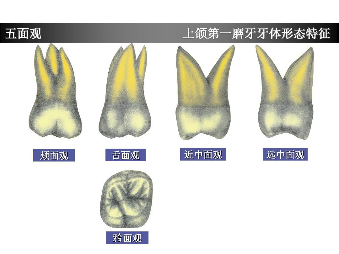 上颌第一磨牙牙体形态简述