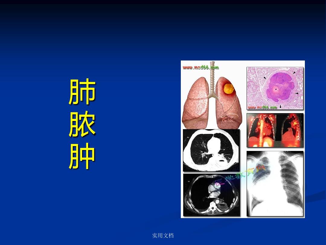 例肺脓肿患者的病例汇报