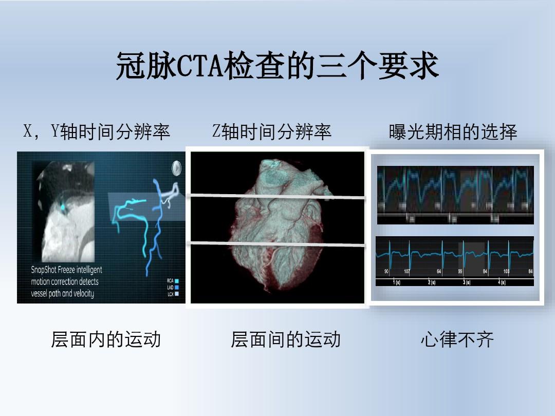 CT冠状动脉成像技术