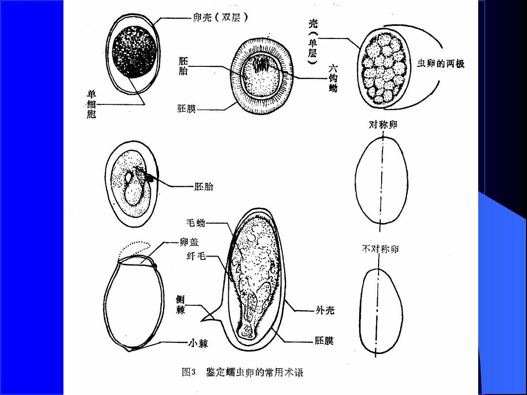 常见肠道蠕虫卵的鉴别(幻灯)