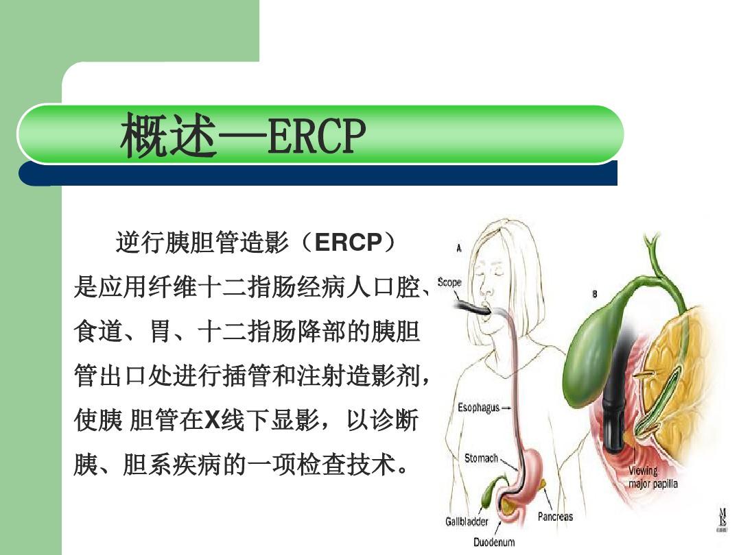 ERCP及术前术后护理ppt【全套】