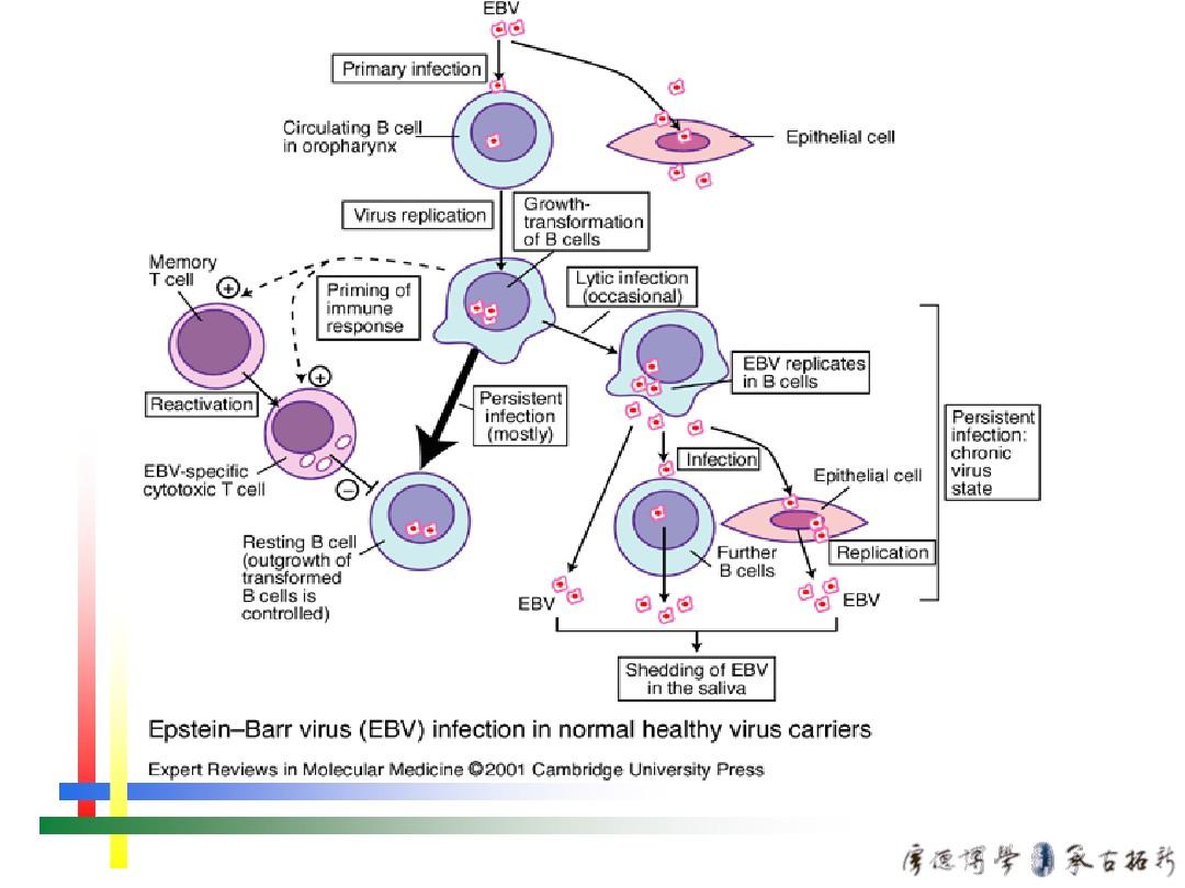 EB病毒感染的特殊表现.总结