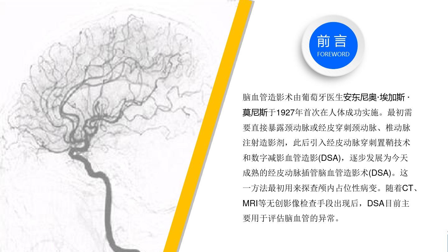 2018脑血管造影术操作规范中国专家共识-幻灯片课件