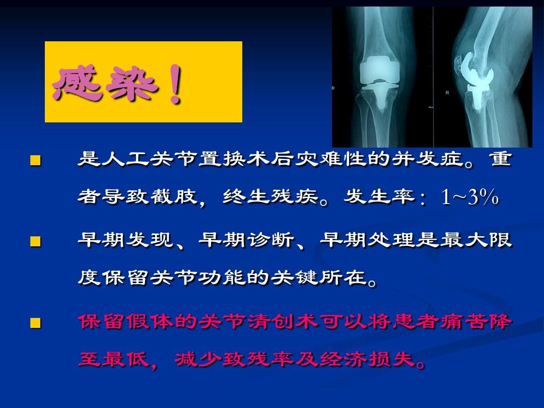 膝关节置换术后感染(清创术)