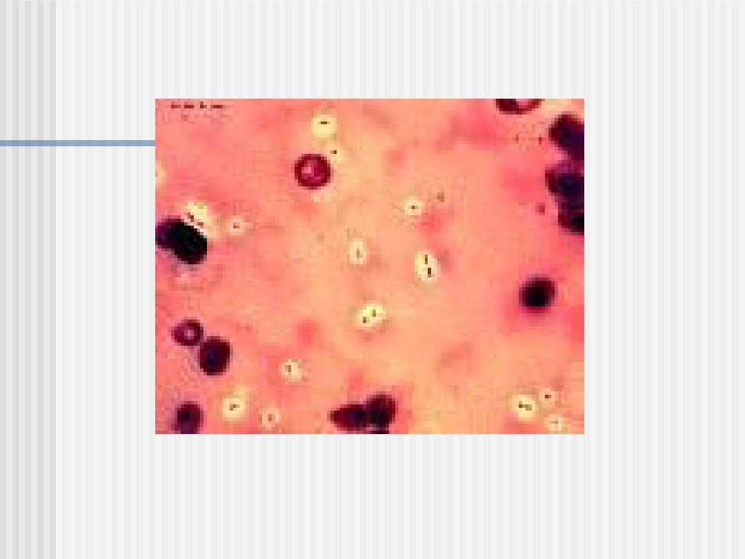 肺炎链球菌和肠球菌