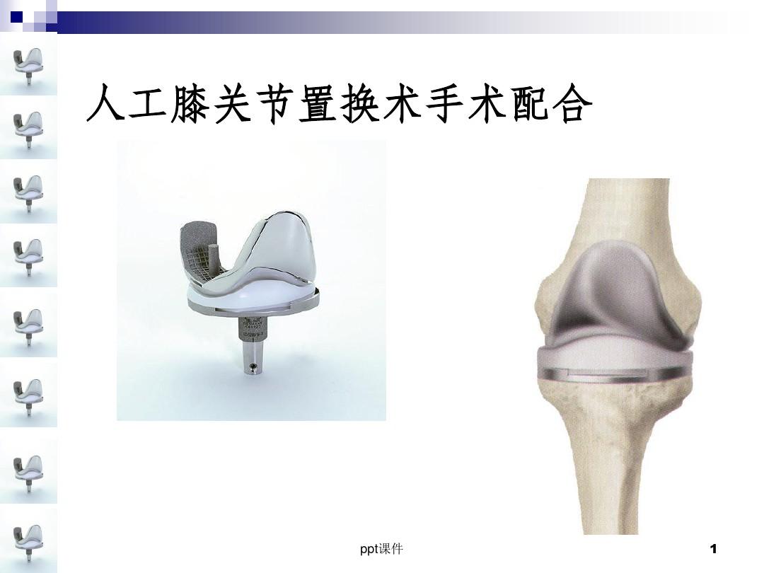 人工膝关节置换术手术配合ppt