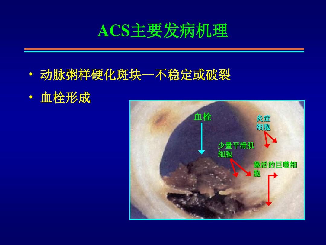 NSTE-ACS危险分层临床因素年龄原有基础的左室功能冠脉解剖 ...