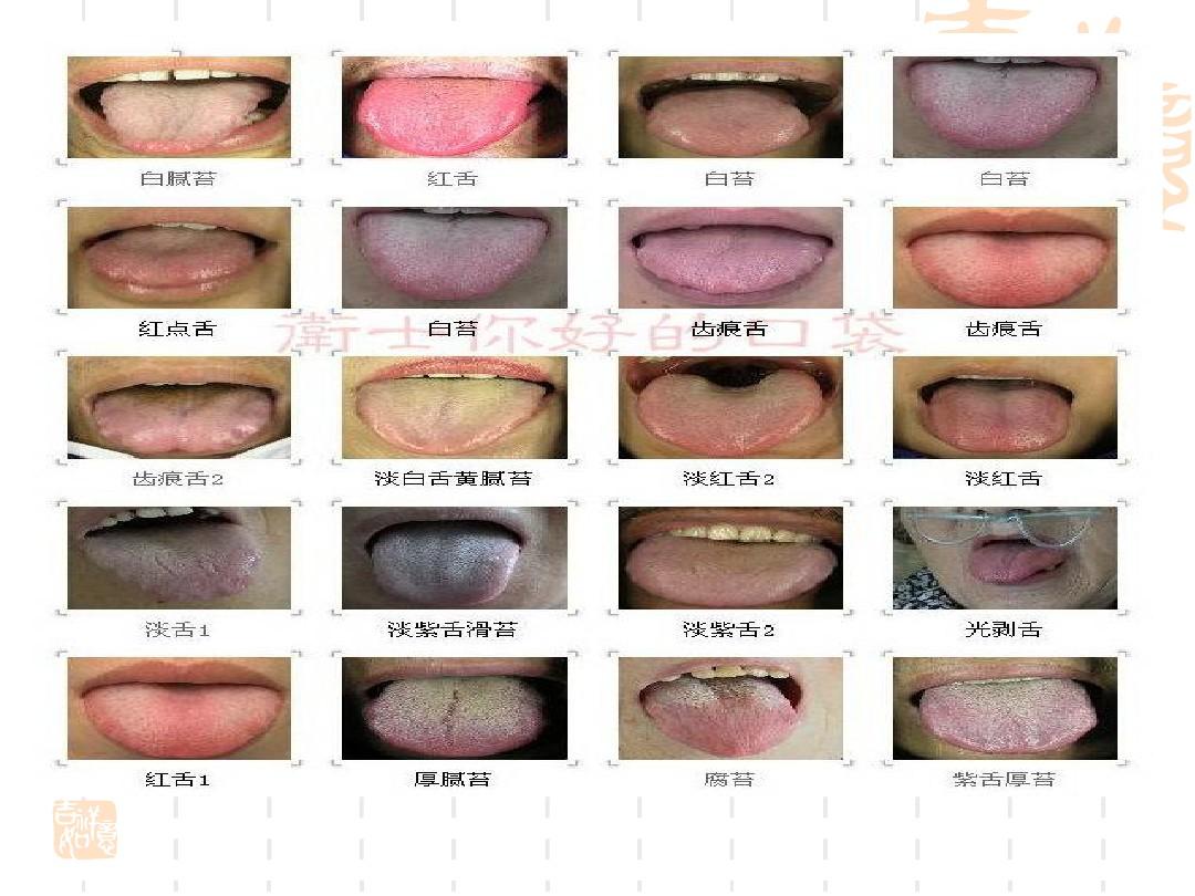 中医舌诊图谱